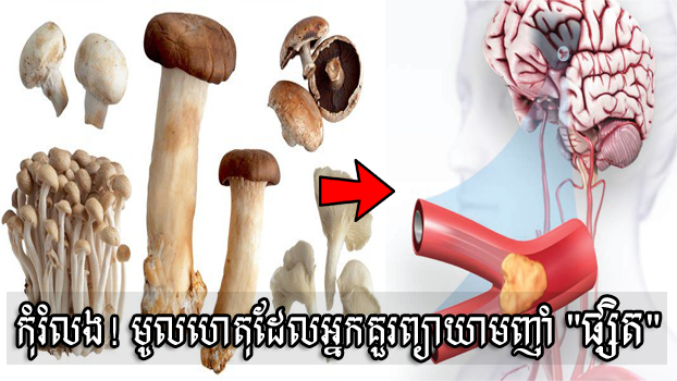 កុំរំលង! មូលហេតុសំខាន់ៗដែលអ្នកគួរព្យាយាមញ៊ាំ “ផ្សិត”