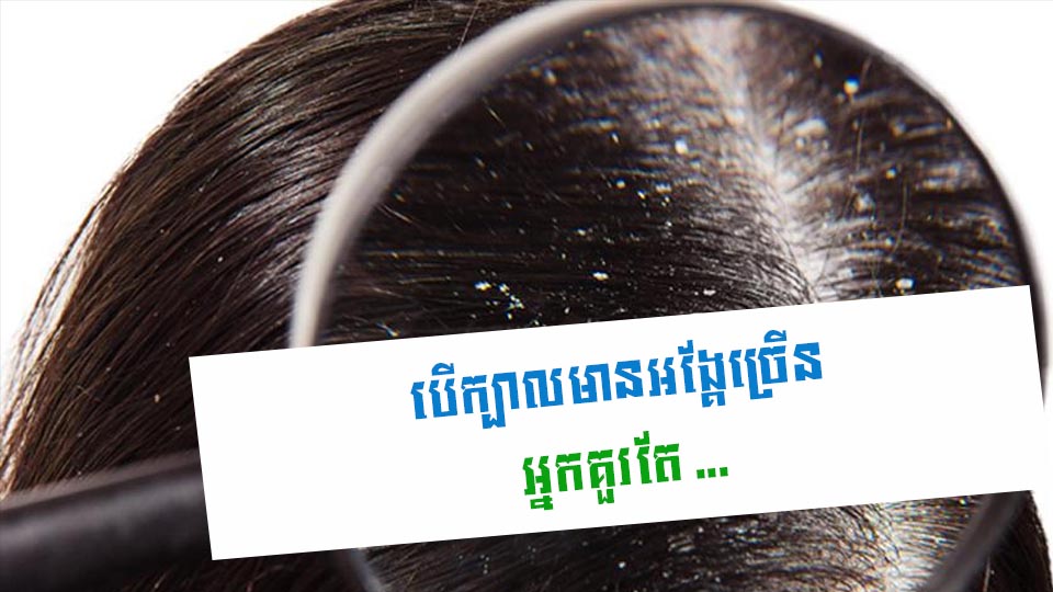 បើក្បាលមានអង្គែច្រើន អ្នកគួរតែ …