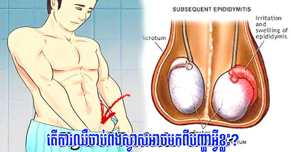 តើការឈឺចាប់ពងស្វាសអាចមកពីបញ្ហាអ្វីខ្លះ?