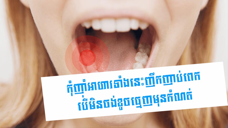 កុំញ៉ាំអាហារទាំងនេះញឹកញាប់ពេក បើមិនចង់ខូចធ្មេញមុនកំណត់