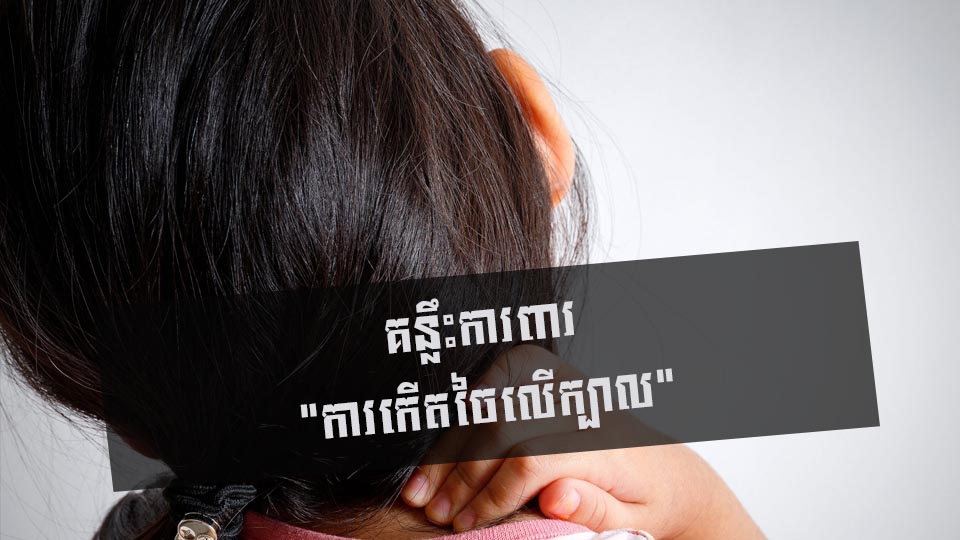 គន្លឹះការពារ “ការកើតចៃលើក្បាល”