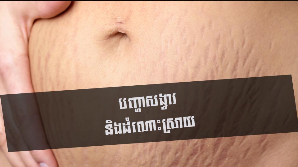 បញ្ហាសង្វារ និងដំណោះស្រាយ
