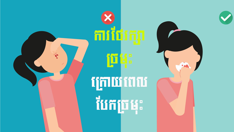 ការថែរក្សាច្រមុះ ក្រោយពេលបែកច្រមុះ
