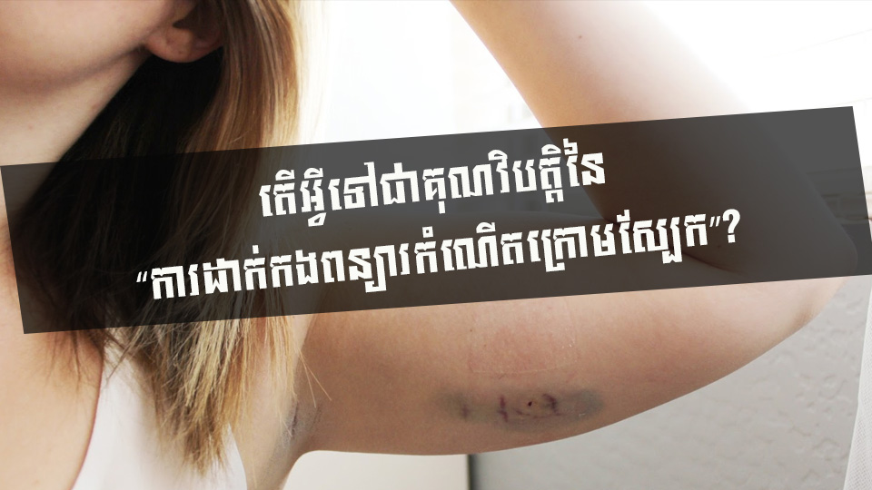 តើអ្វីទៅជាគុណវិបត្តិនៃ “ការដាក់កងពន្យារកំណើតក្រោមស្បែក”?