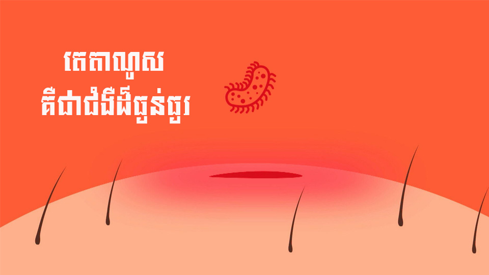 ចូរប្រយ័ត្ន ៖ តេតាណូស គឺជាជំងឺដ៏ធ្ងន់ធ្ងរ