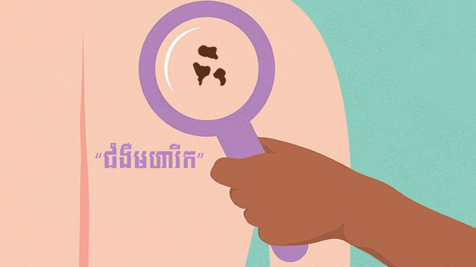 សញ្ញាទូទៅ និងរោគសញ្ញានៃ “ជំងឺមហារីក”