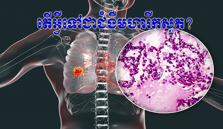 តើអ្វីទៅជាជំងឺមហារីកសួត?