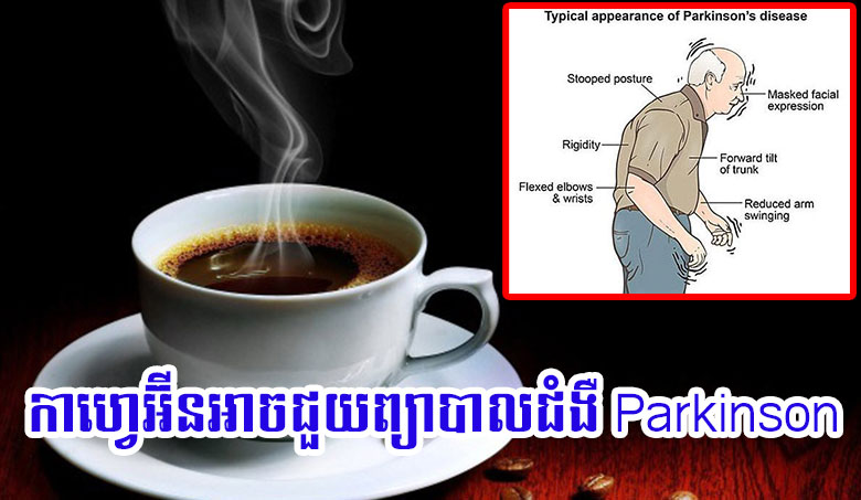កាហ្វេអ៊ីនអាចជួយព្យាបាលជំងឺ Parkinson