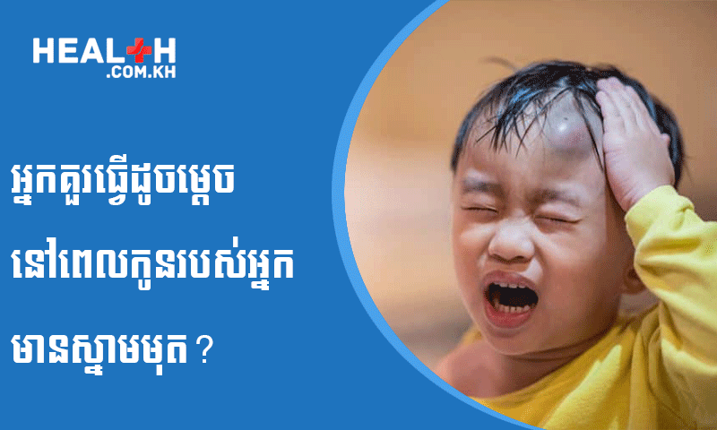 អ្នកគួរធ្វើដូចម្តេចនៅពេលកូនរបស់អ្នកមានស្នាមមុត?