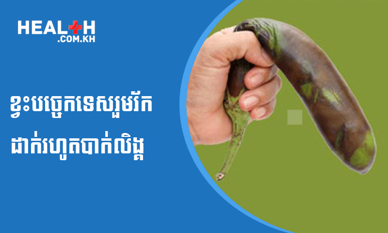 ខ្វះបច្ចេកទេសរួមរ័ក ដាក់រហូតបាក់លិង្គ