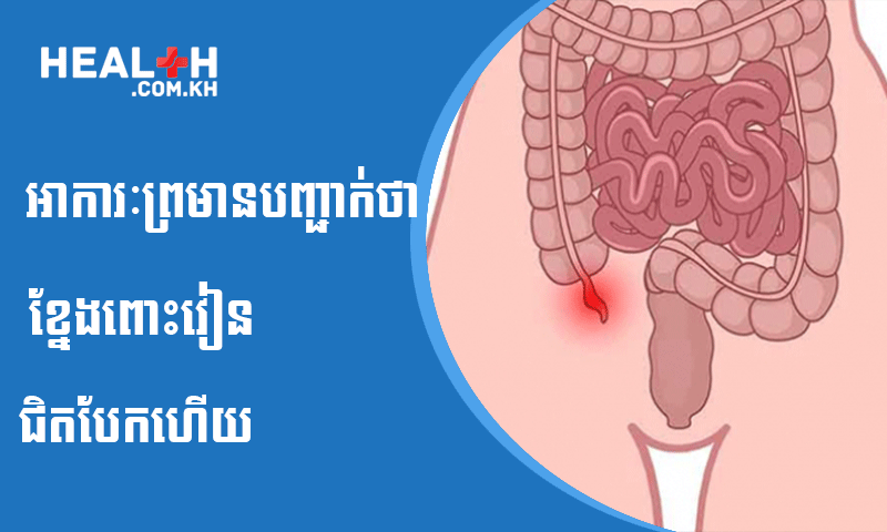 អាការៈព្រមានបញ្ជាក់ថា ខ្នែងពោះវៀនជិតបែកហើយ