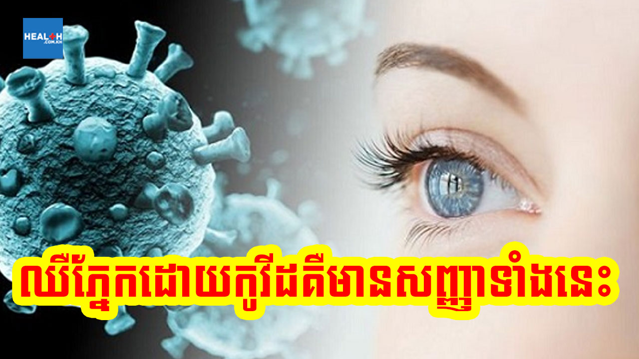 ពេលមេរោគកូវីដវាយប្រហារភ្នែក វាចេញសញ្ញាទាំងនេះ