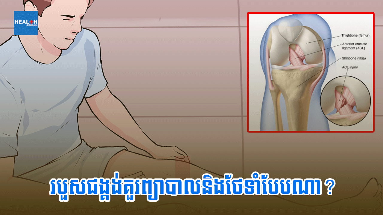 របួសជង្គង់គួរព្យាបាលនិងថែទាំបែបណា?
