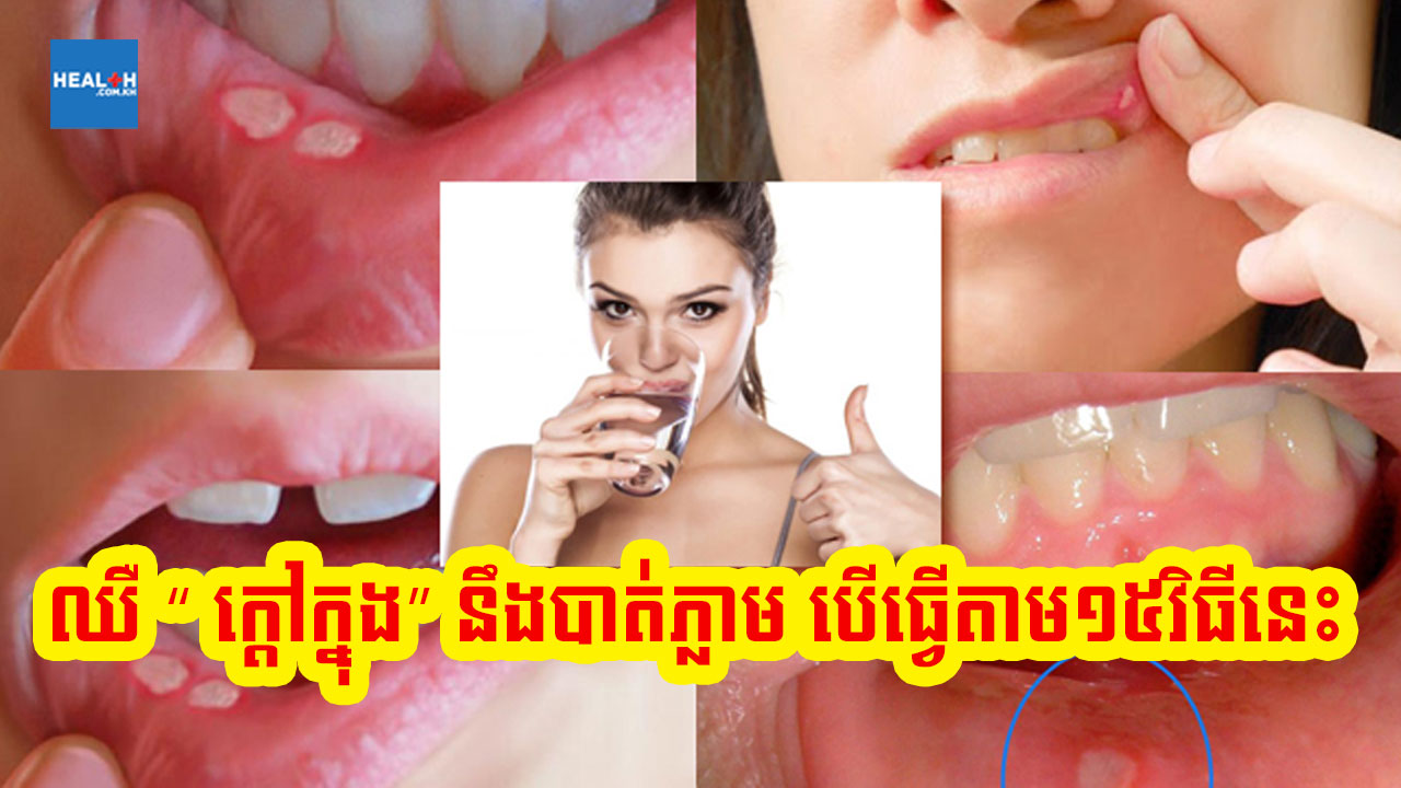 ឈឺ “ ក្តៅក្នុង” នឹងបាត់ភ្លាម បើធ្វើតាម១៥វិធីនេះ
