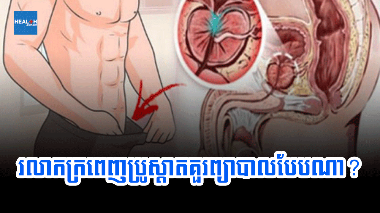 រលាកក្រពេញប្រូស្តាតគួរព្យាបាលបែបណា?