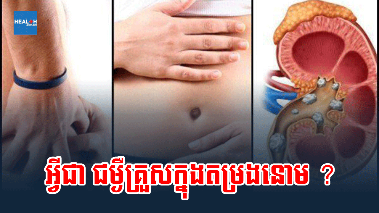 អ្វីជា ជម្ងឺគ្រួសក្នុងតម្រងនោម ?