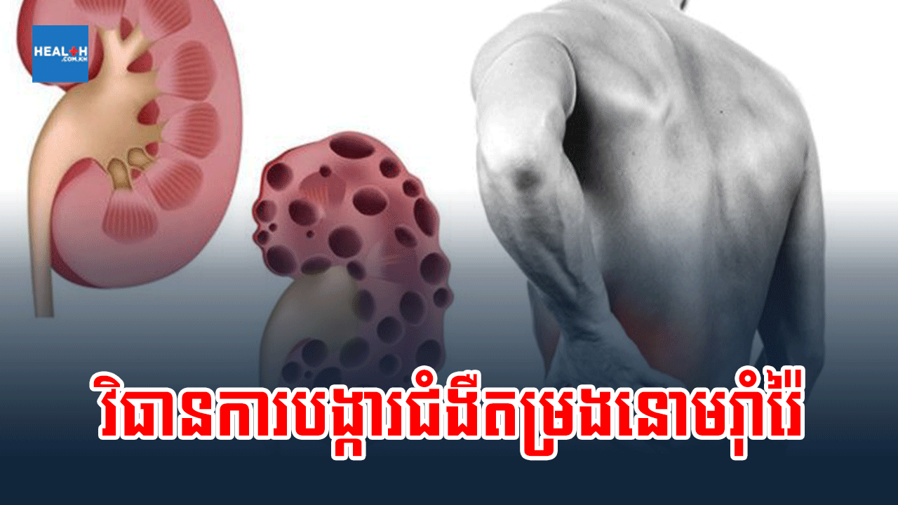 វិធានការបង្ការជំងឺតម្រងនោមរ៉ាំរ៉ៃ