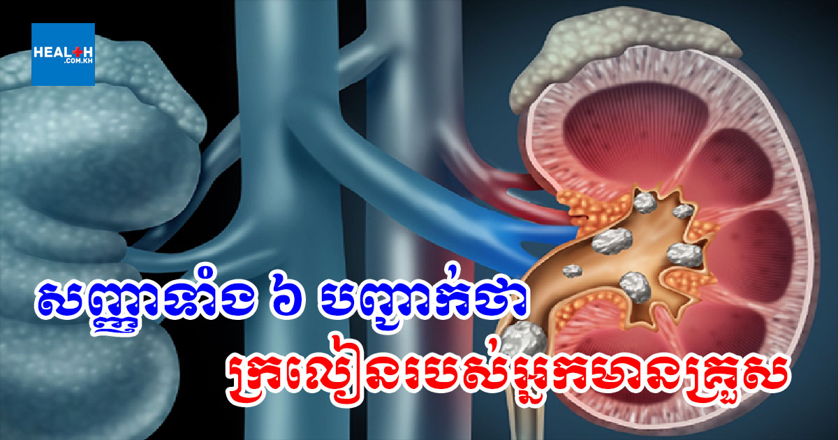 សញ្ញាទាំង៦ បញ្ជាក់ថាក្រលៀនរបស់អ្នកមានគ្រួស