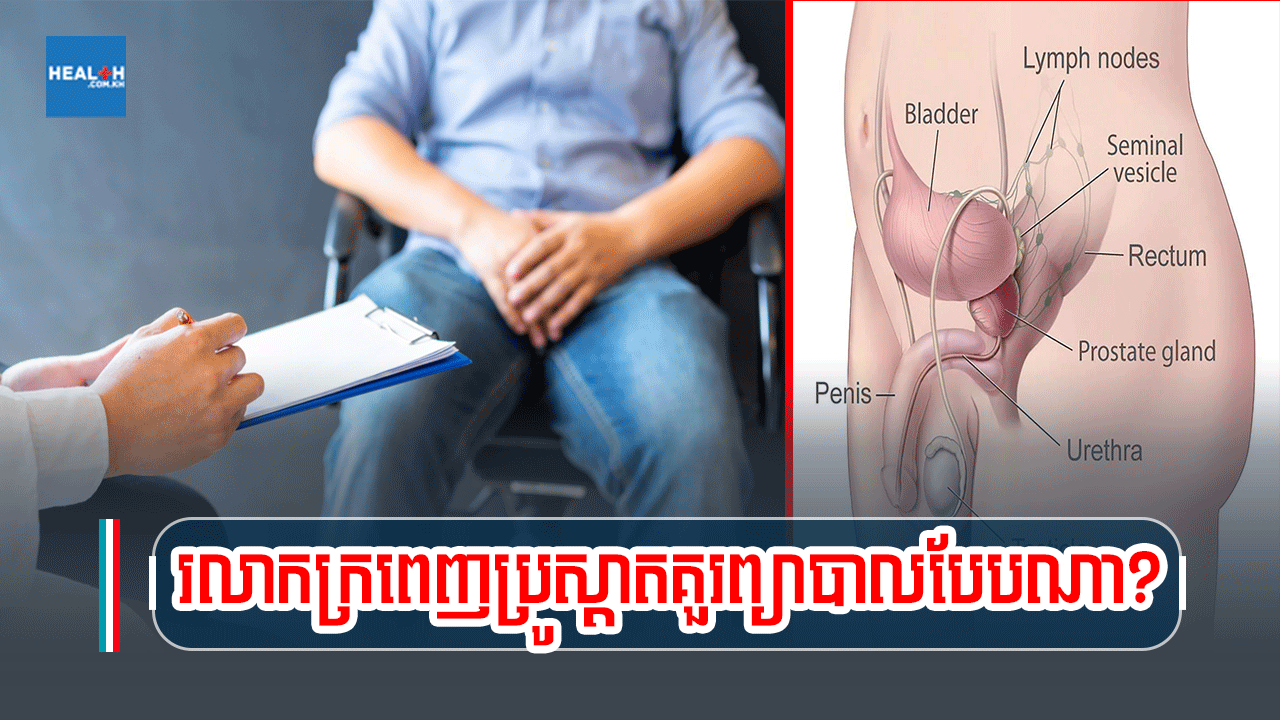 រលាកក្រពេញប្រូស្តាតគួរព្យាបាលបែបណា?