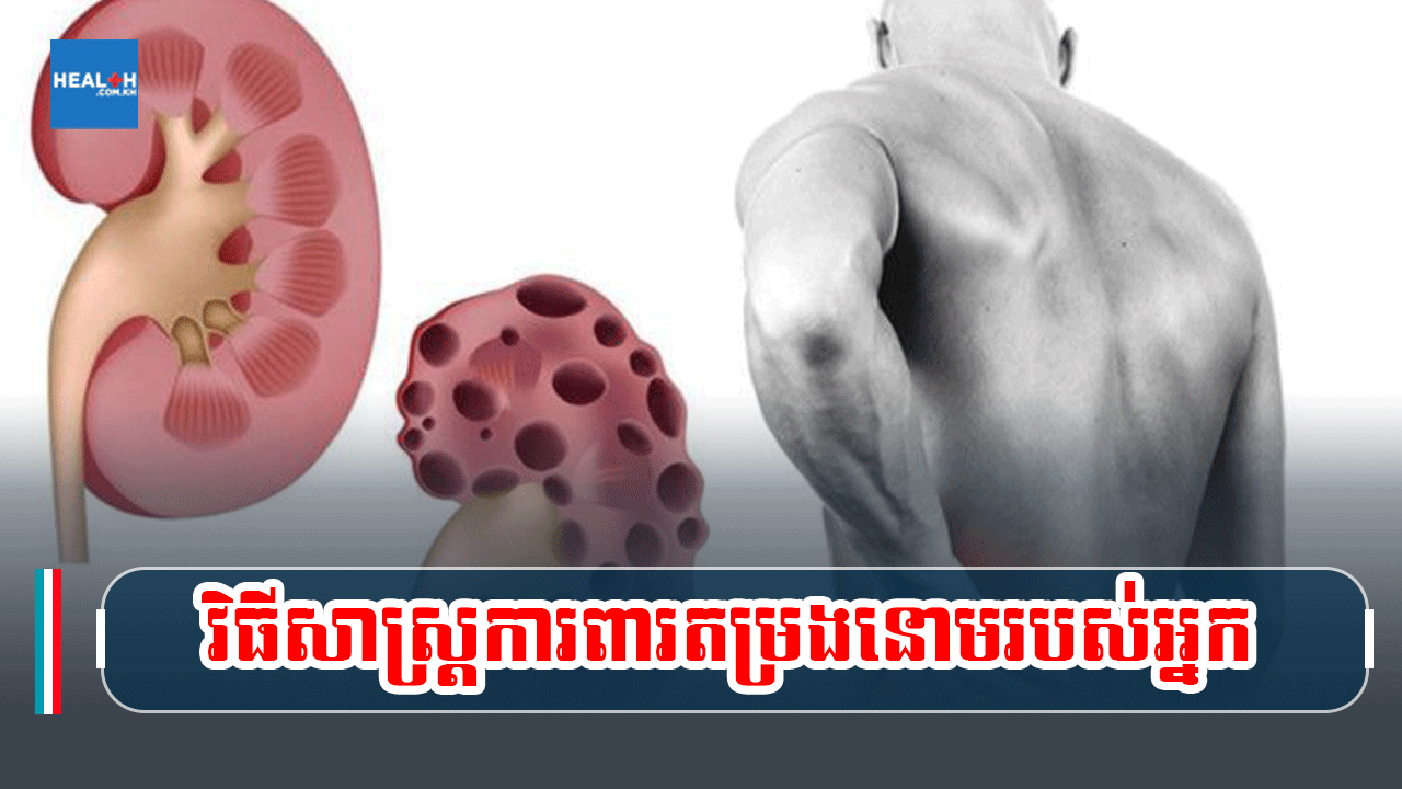 វិធីសាស្ត្រការពារតម្រងនោមរបស់អ្នក