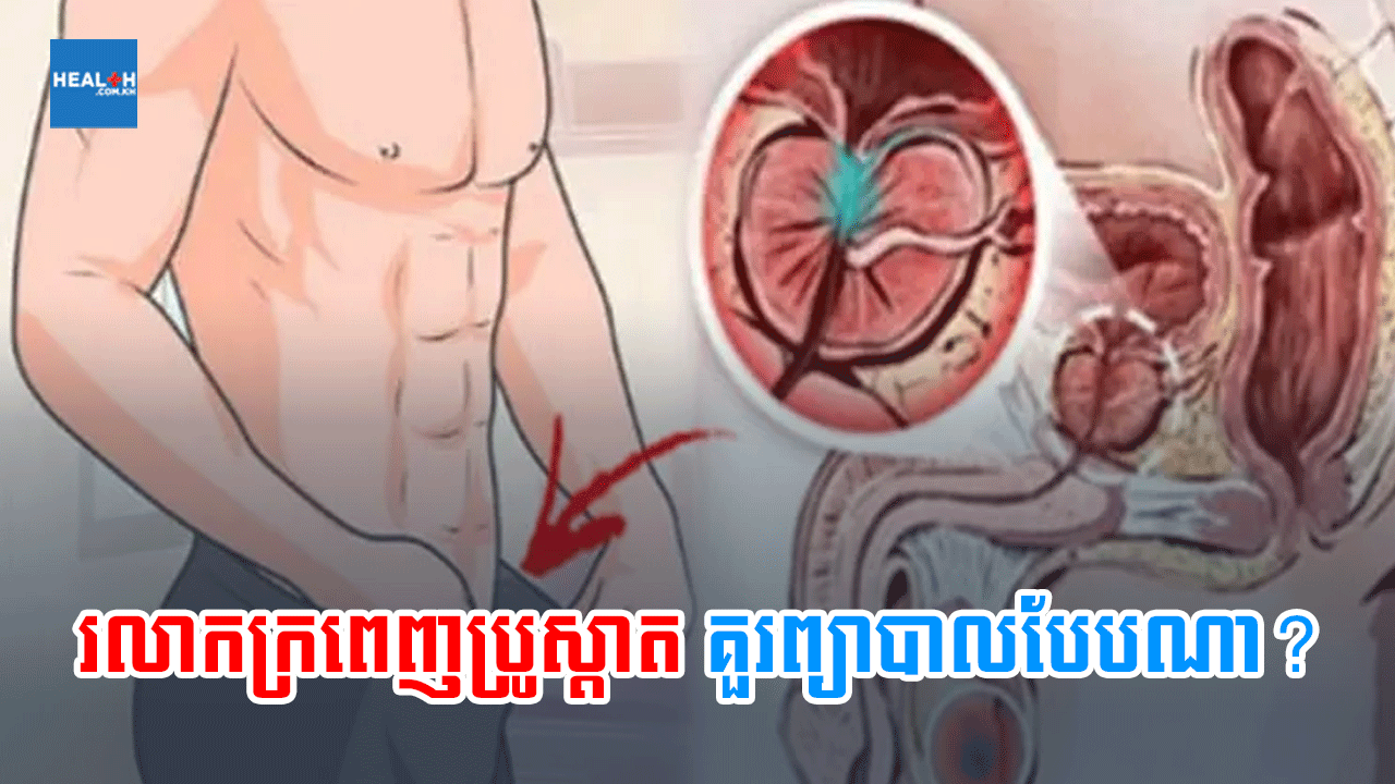រលាកក្រពេញប្រូស្តាតគួរព្យាបាលបែបណា?