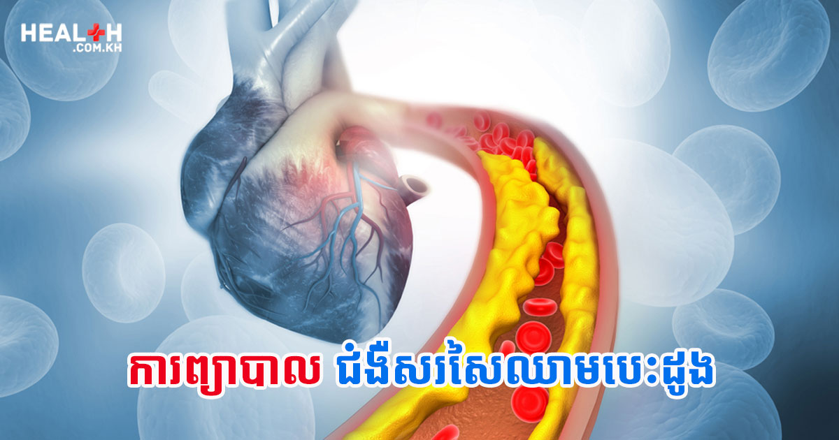 ការព្យាបាលជំងឺសរសៃឈាមបេះដូង