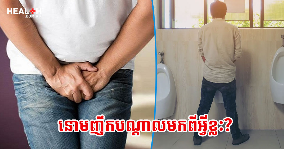 នោមញឹកបណ្តាលមកពីអ្វីខ្លះ?