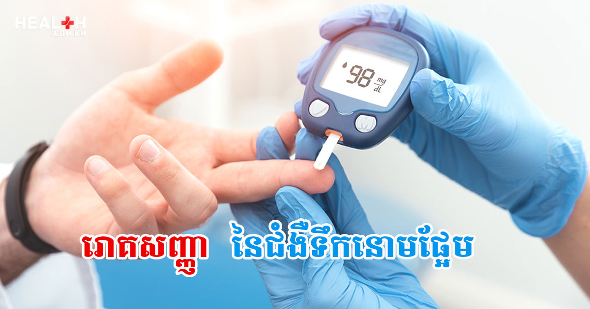 រោគសញ្ញា នៃជំងឺទឹកនោមផ្អែម