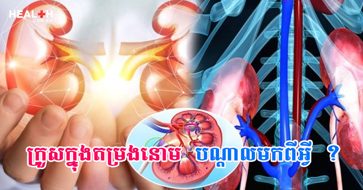 ក្រួសក្នុងតម្រងនោមបណ្តាលមកពីអ្វី ?