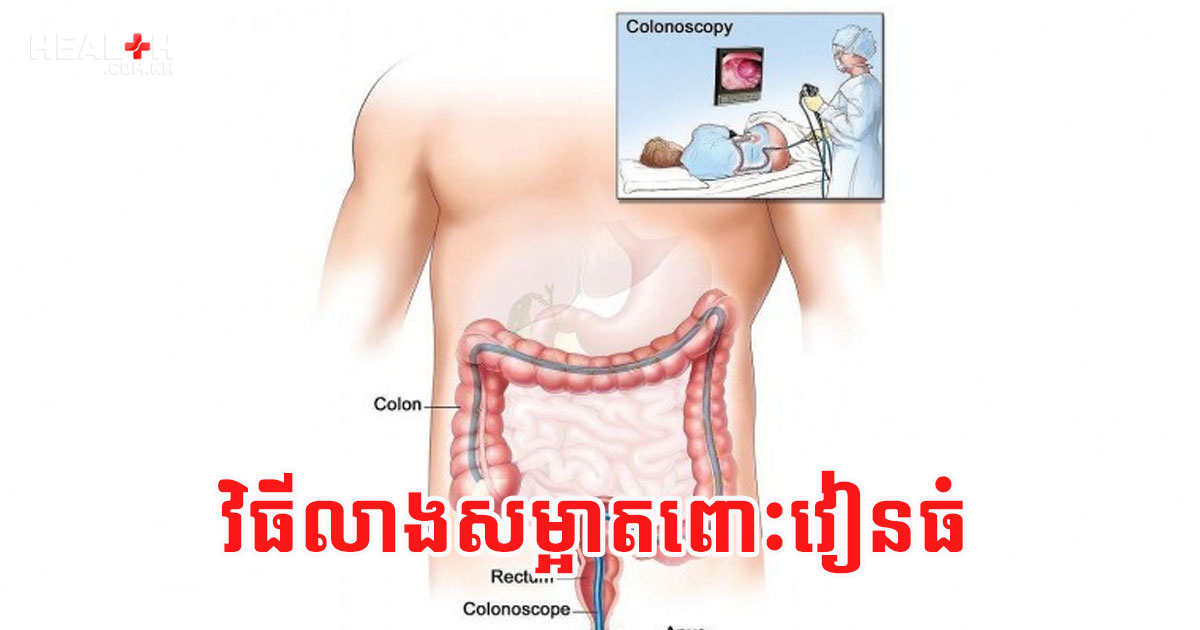 វិធីលាងសម្អាតពោះវៀនធំ