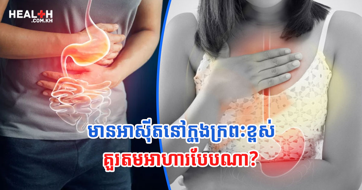មានអាស៊ីតនៅក្នុងក្រពះខ្ពស់ គួរតមអាហារបែបណា?