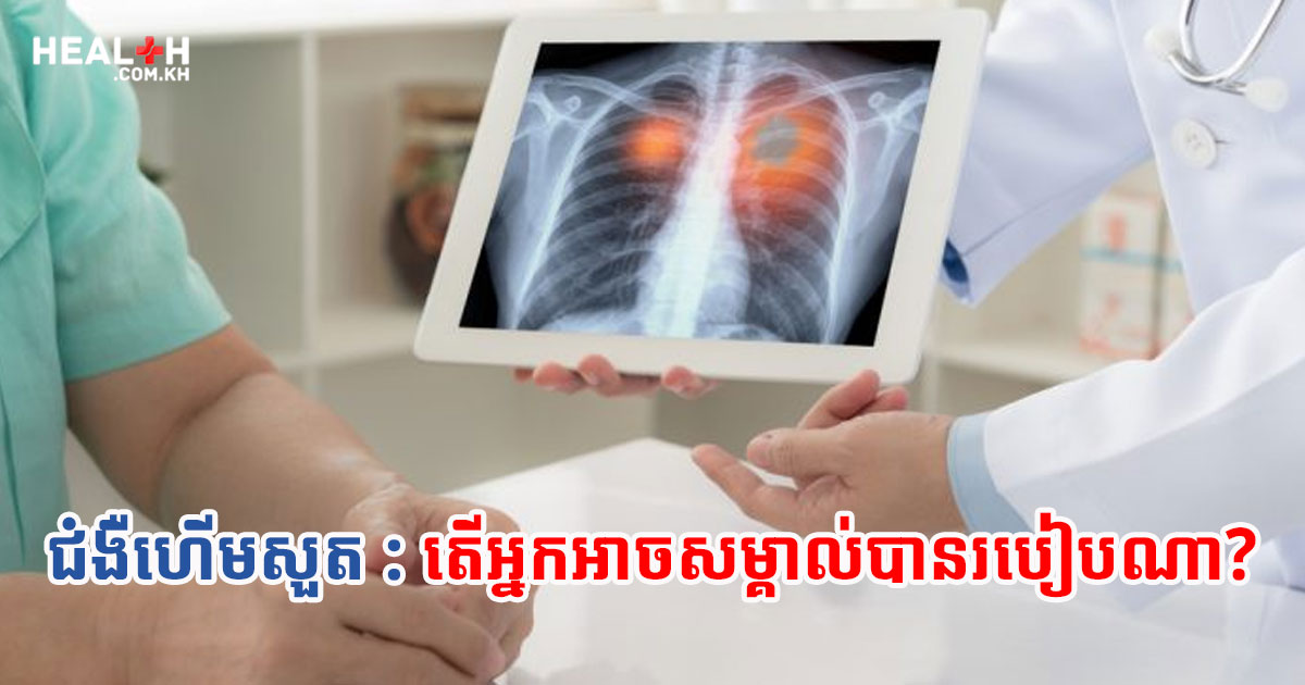 ជំងឺហើមសួត:តើអ្នកអាចសម្គាល់បានរបៀបណា?