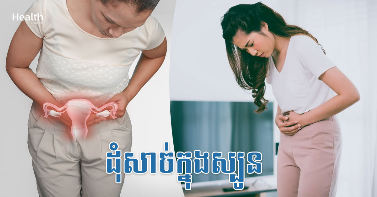 ដុំសាច់ក្នុងស្បូន