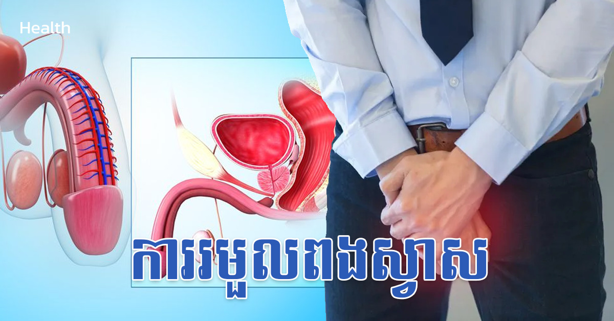 ការរមួលពងស្វាស