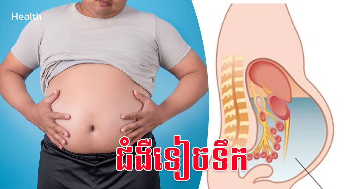 សេចក្តីលម្អិតអំពីជំងឺទៀចទឹក