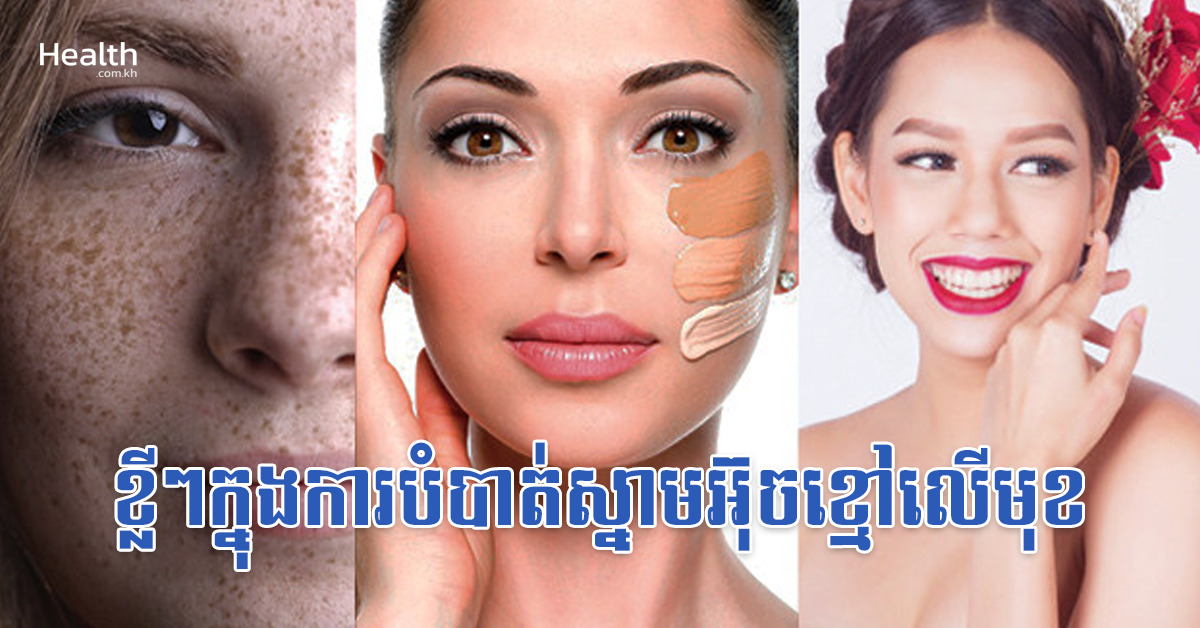 ខ្លីៗក្នុងការបំបាត់ស្នាមអ៊ុចខ្មៅលើមុខ