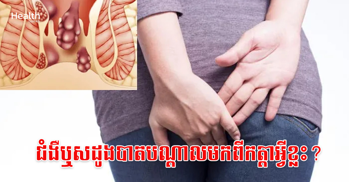 ជំងឺឬសដូងបាតបណ្តាលមកពីកត្តាអ្វីខ្លះ?