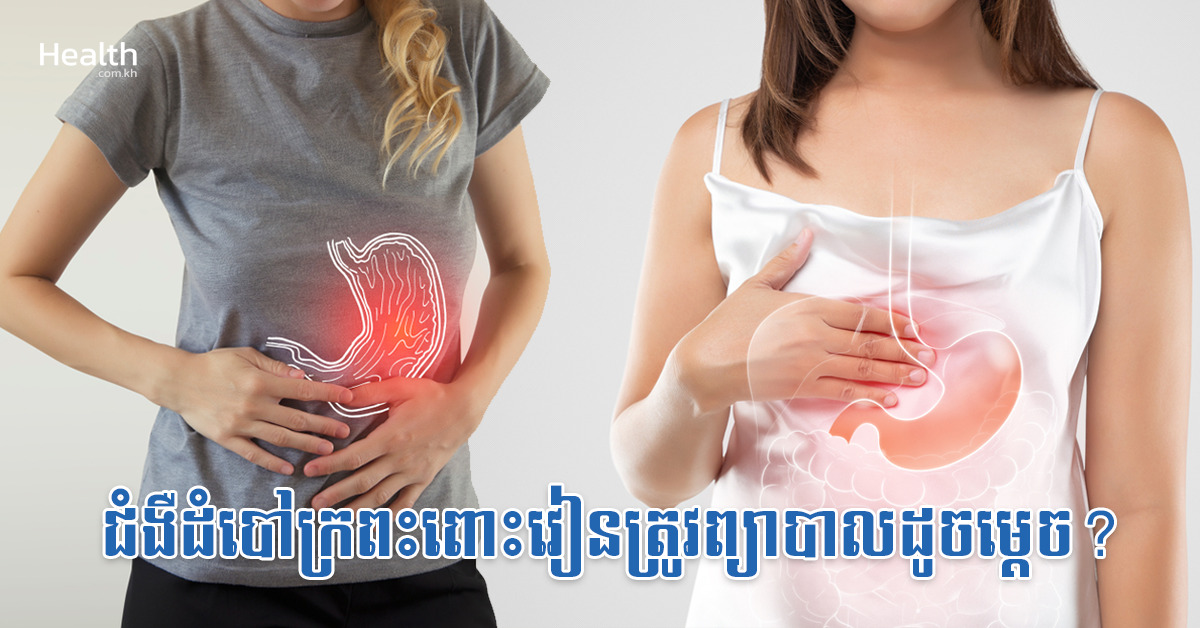 ជំងឺដំបៅក្រពះពោះវៀនត្រូវព្យាបាលដូចម្តេច?