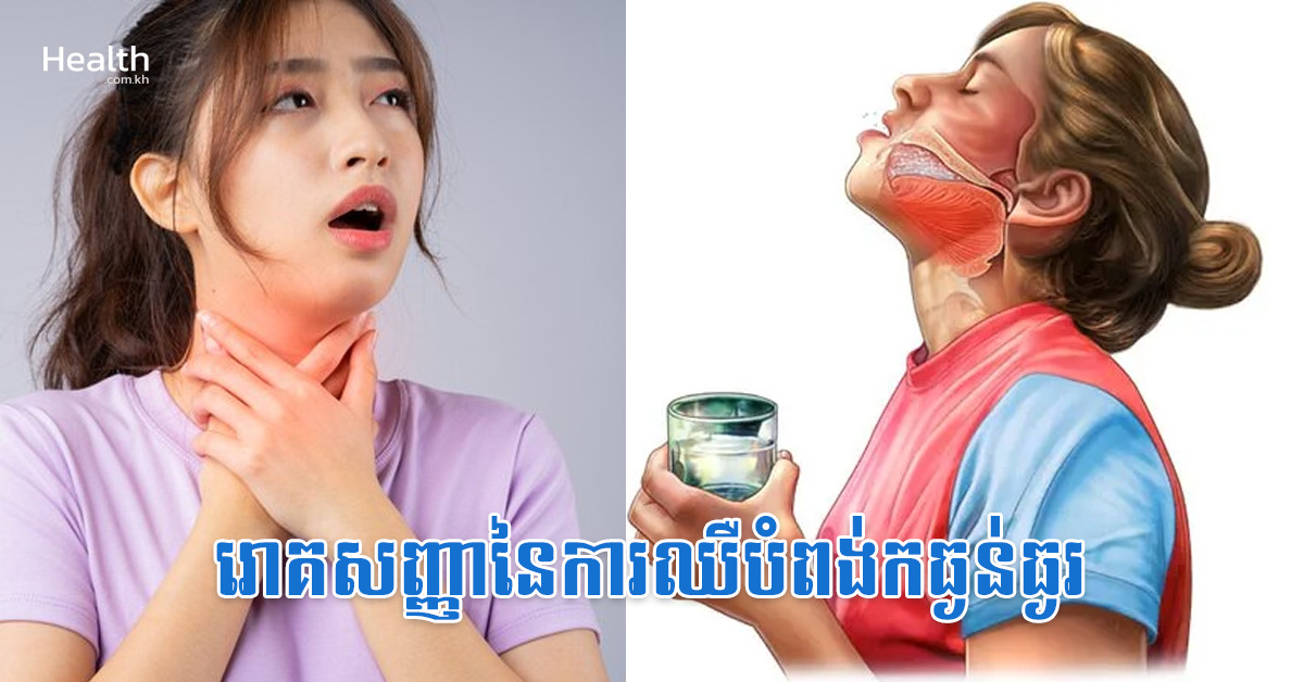 រោគសញ្ញានៃការឈឺបំពង់កធ្ងន់ធ្ងរ