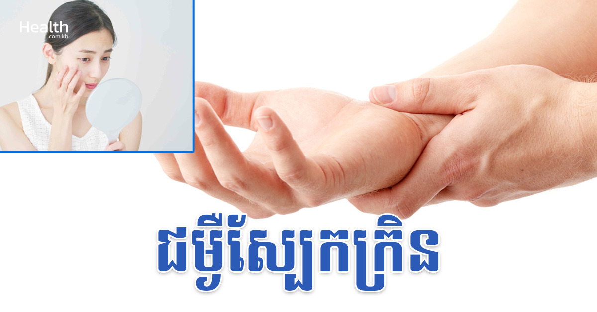 ស្បែកក្រិន