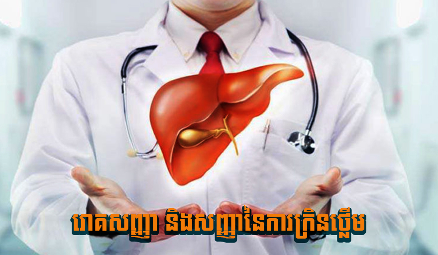 ជំងឺក្រិនថ្លើម អាចមានរោគសញ្ញាអ្វីខ្លះ?