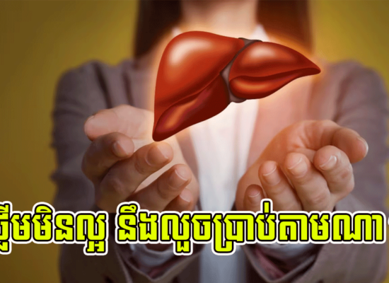 ថ្លើមមិនល្អ នឹងលួចប្រាប់តាមណា?