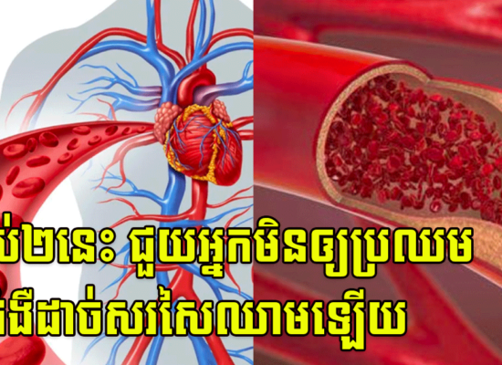 ទម្លាប់២នេះ ជួយអ្នកមិនឲ្យប្រឈមនឹងជំងឺដាច់សរសៃឈាមឡើយ