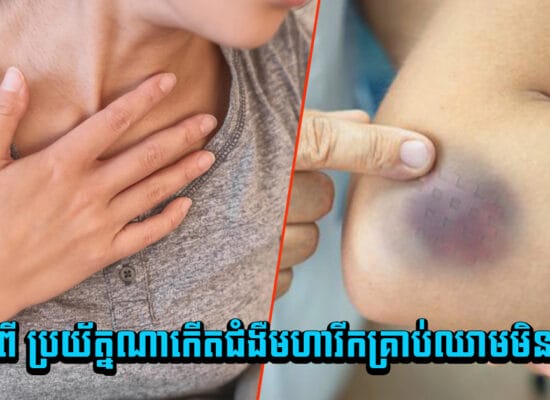 ស្រីៗមិនខ្វល់ មិនអើពើ! ប្រយ័ត្នណាកើតជំងឺមហារីកគ្រាប់ឈាមមិនដឹងខ្លួន