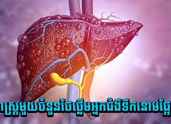 ឈប់បារម្ភ ! យុទ្ធសាស្ត្រមួយចំនួនថែថ្លើមអ្នកជំងឺទឹកនោមផ្អែមឲ្យល្អ