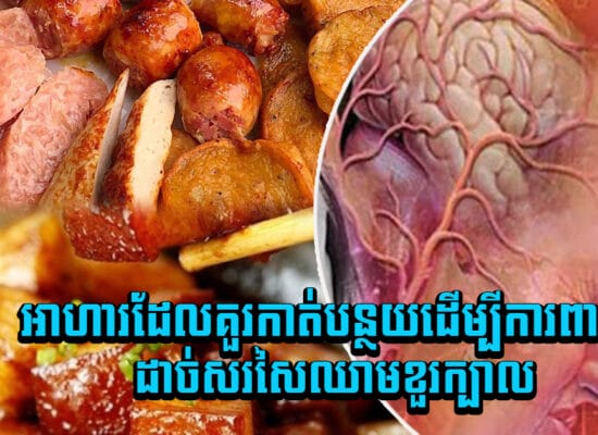 ដាច់សរសៃឈាមខួរក្បាលមិនហ៊ានមកជិតទេ បើអ្នកធ្វើតាមវិធីទាំងនេះ