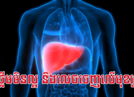 ថ្លើមមិនល្អ នឹងលេចចេញលើមុខអ្នក