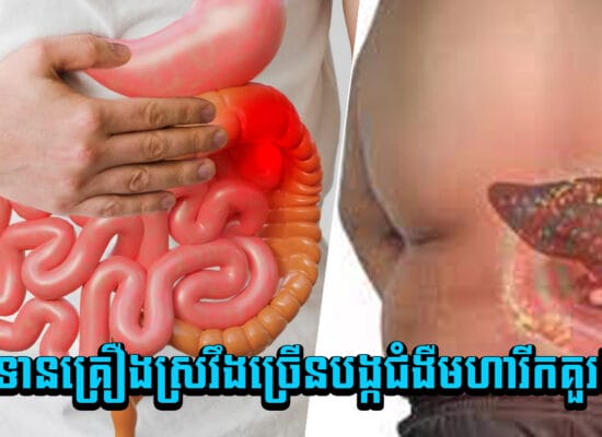 កុំចេះតែហ៊ានពេក ! ទទួលទានគ្រឿងស្រវឹងច្រើនបង្កជំងឺមហារីកគួរឱ្យខ្លាច