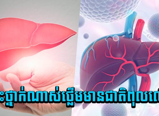 គ្រោះថ្នាក់ណាស់ថ្លើមមានជាតិពុលលើស ! បើដឹងខ្លួនទៅជួបគ្រូពេទ្យឲ្យហើយកុំទុក