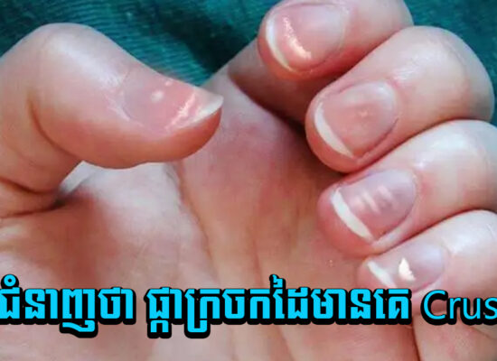 អ្នកជំនាញថា ផ្កាក្រចកដៃមានគេ Crush?